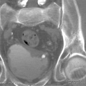 ct urography with and without contrast
